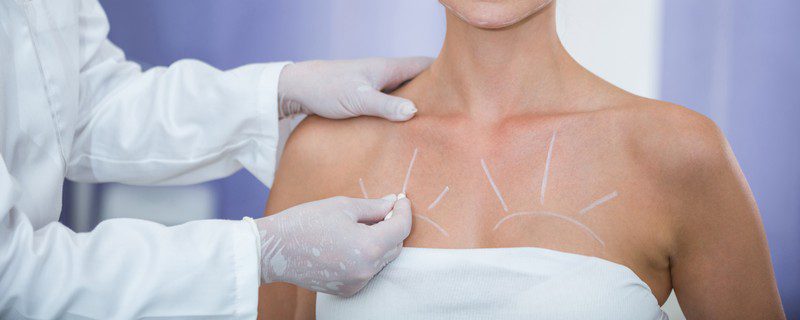 Подтяжка груди (мастопексия) в СПБ: фото и цены | Медиэстетик