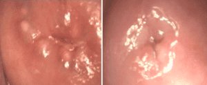Фото до-после 12